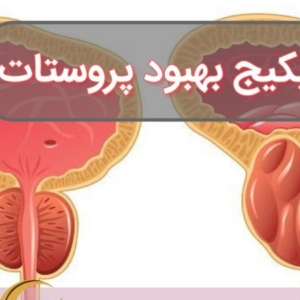 محصول نمونه 7پک پاک سازی پرستات
