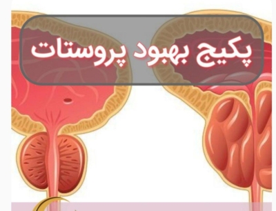 محصول نمونه 7پک پاک سازی پرستات
