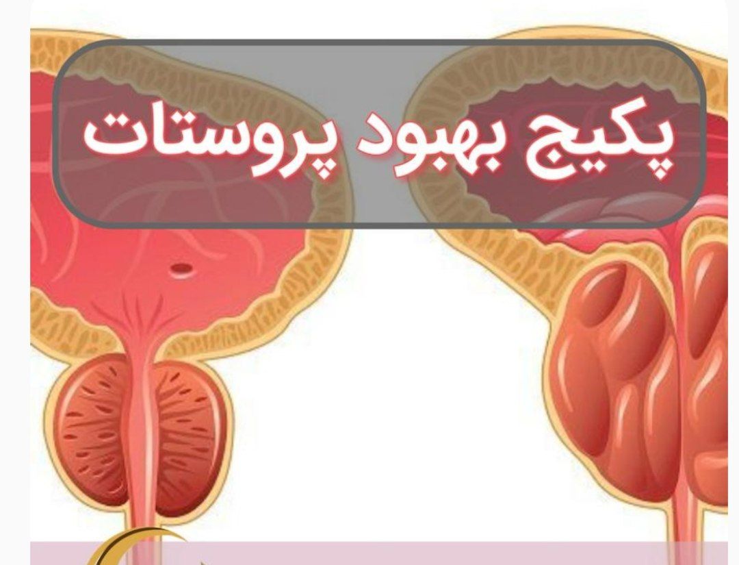 محصول نمونه 7پک پاک سازی پرستات